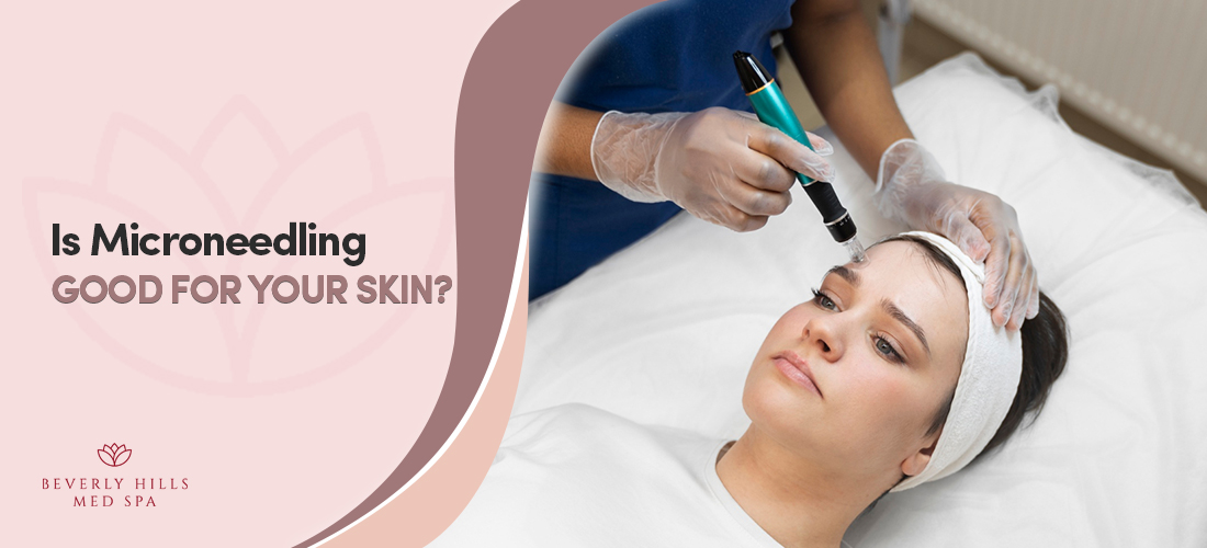 Is Microneedling Good for your Skin? Beverly Hills Med Spa